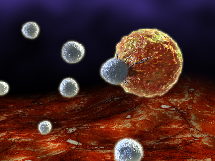 T-cells attacking a cancer cell. Digital illustration.