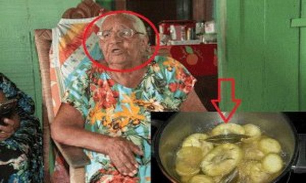 this-woman-of-95-years-could-not-stand-because-of-pain-in-the-joints-and-today-reveals-the-remedy-used-to-heal-definitively-doctors-have-done-tests-you-and-this-remedy-cured-her-100