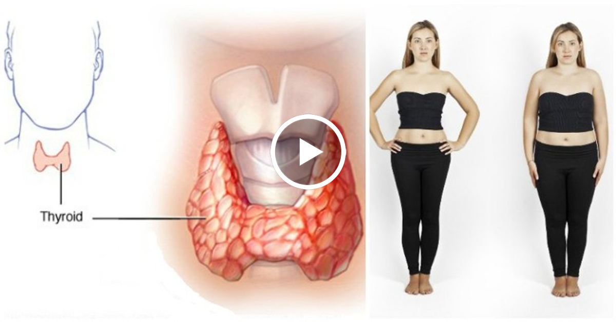 Щитовидная Железа И Лишний Вес У Женщин