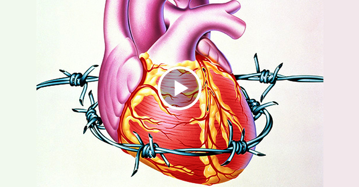 Язва сердца. Кардиогенный ШОК сердце. Стенокардия и кардиогенный ШОК.