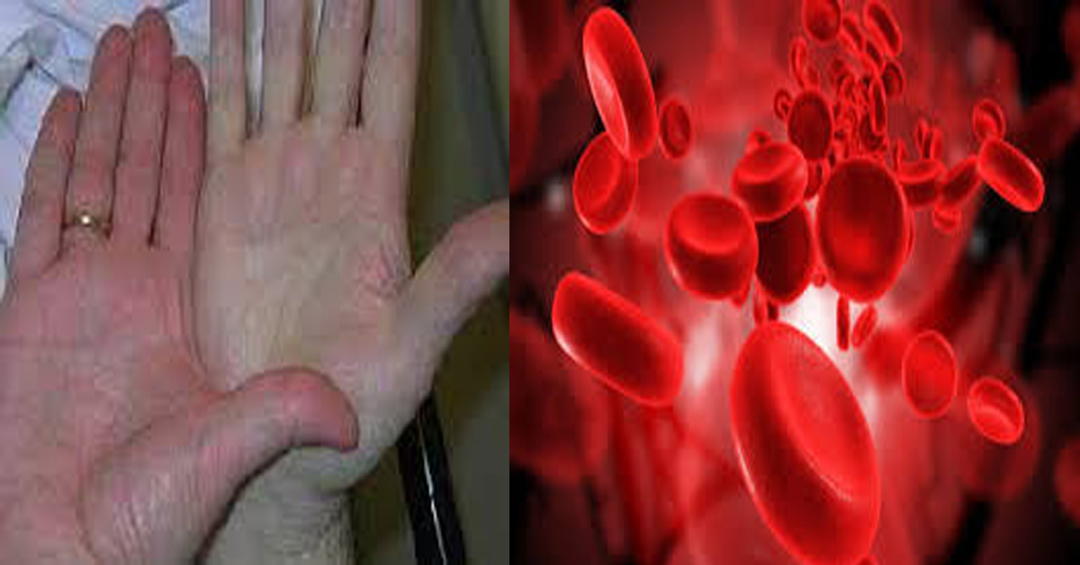 Золотая кровь у человека. Цвет крови с низким гемоглобином. Гемоглобин фото.